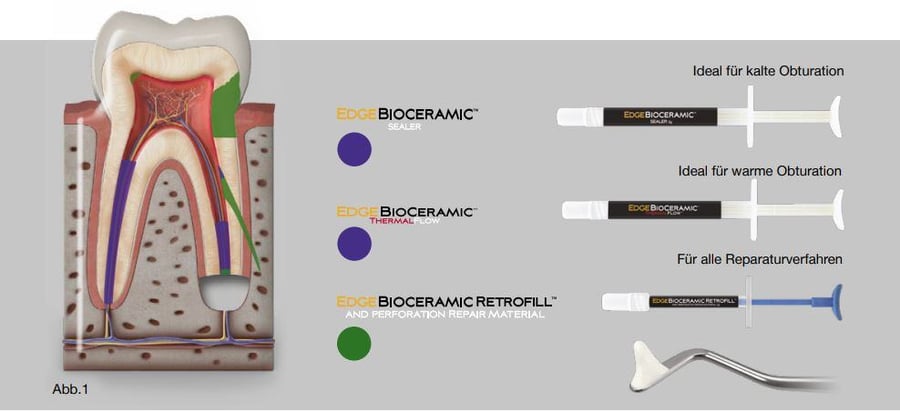 EdgeBioceramic-Produktlinie